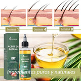 Aceite De Batana Para El Crecimiento Del Cabello - Paga Al Recibir en Tu Domicilio