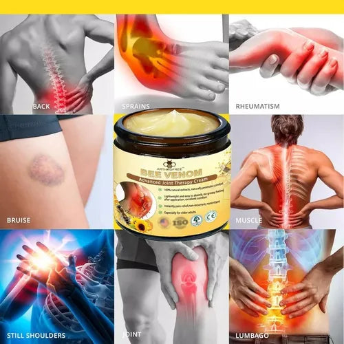 Pomada para combatir dolores articulares, artritis y artrosis - Pagala Al Recibir en Tu Domicilio